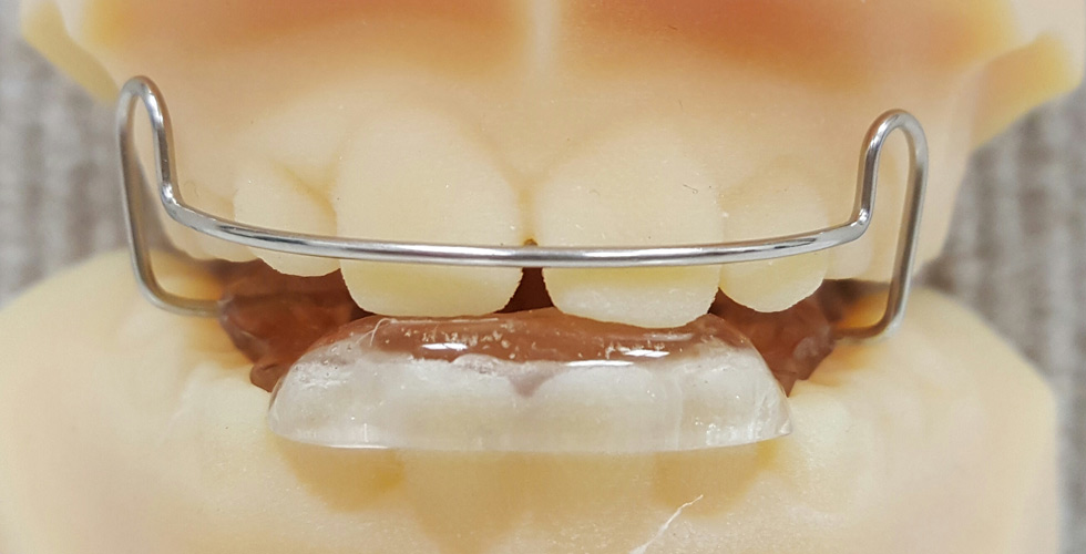 Bionator - Orthodontist in Marin