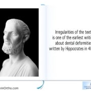 Orthodontic Fact #9 Irregularities of the teeth is one of the earliest writings about dental deformities, written by Hippocrates in 400 BC 7