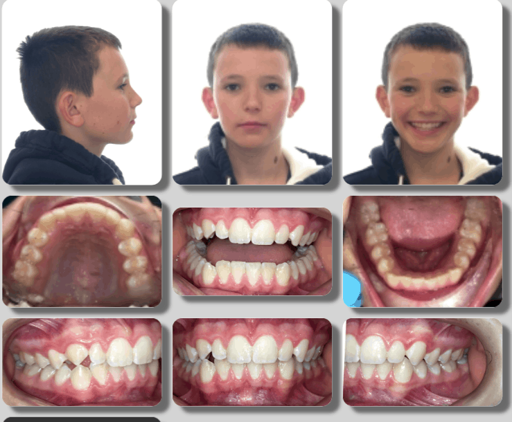 Taking photos of your teeth examples